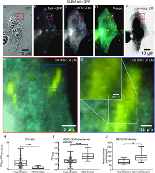 Anti-correlation of HER2 and focal adhesion complexes in the plasma membrane
